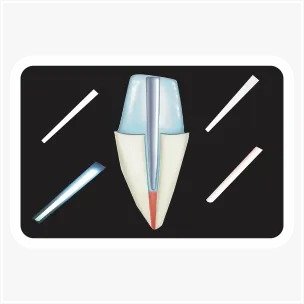 Ammdent Glass Fiber Post